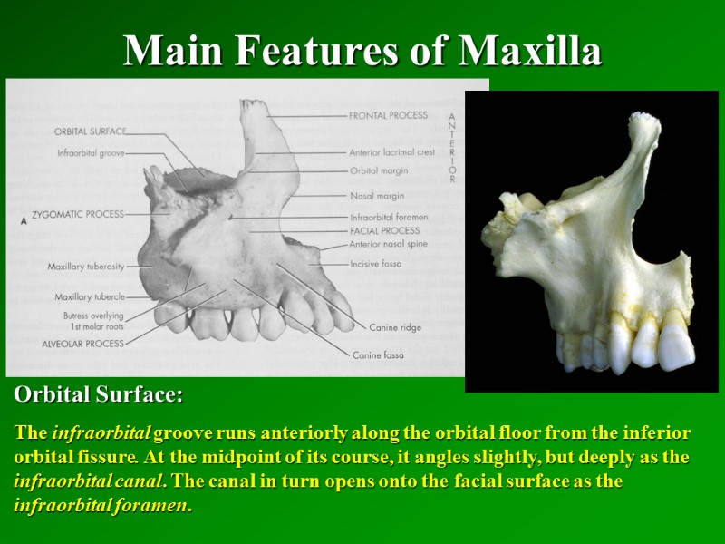 Main Features of Maxilla   Orbital Surface: The infraorbital groove runs anteriorly along
